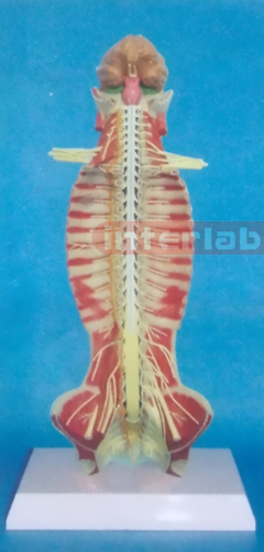 SMALL HUMAN SPINAL CORD MODEL IN SPINAL CANAL